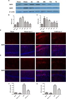 Inhibition of Necroptosis Rescues SAH-Induced Synaptic Impairments in Hippocampus via CREB-BDNF Pathway